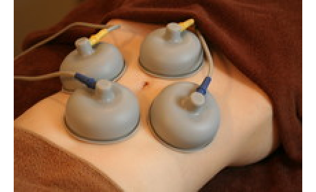 けんじ接骨院EMS